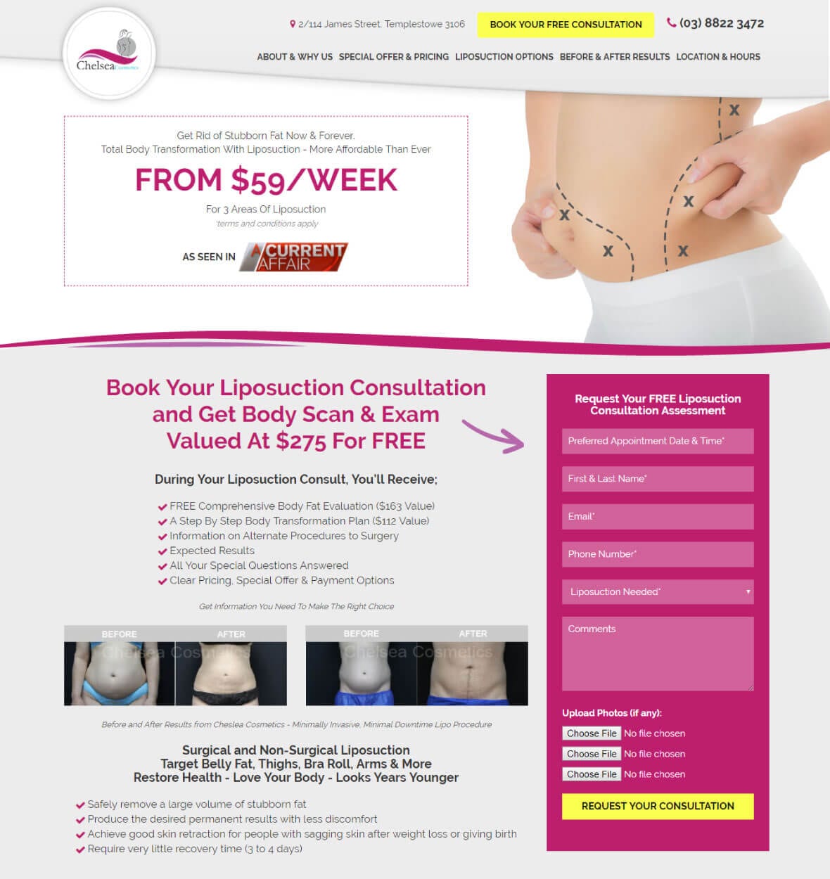 Dedicated landing page for liposuction services