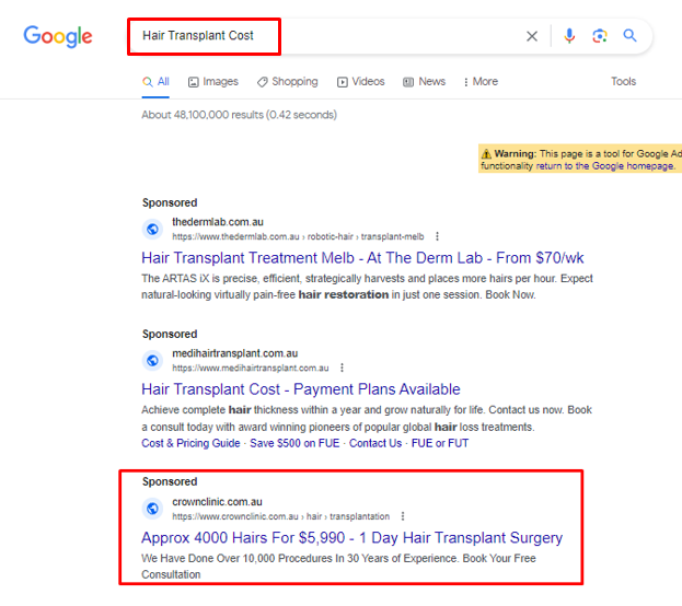Google Ads Hair Transplant Cost