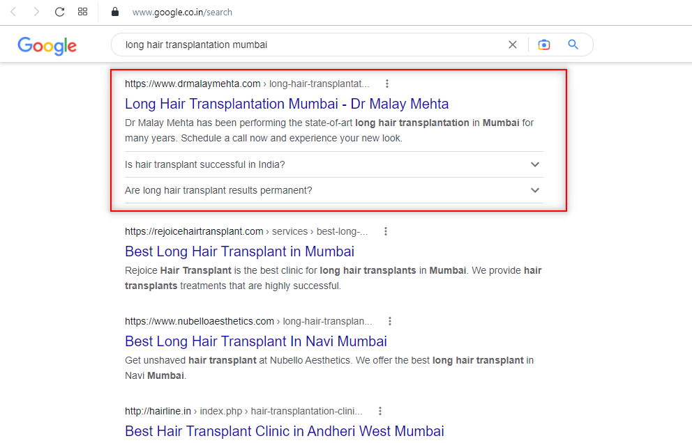 long hair transplantation mumbai