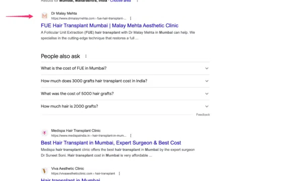 Fue Hair Transplant Mumbai