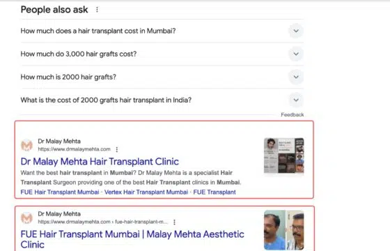 Dr Malay Ranks Number 1 For Hair Transplant Mumbai - Marketing For Hair Transplant Clinics