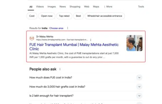 Fue Hair Transplant India