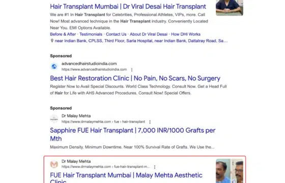 Malay Mehta 1st for fue hair transplant mumbai