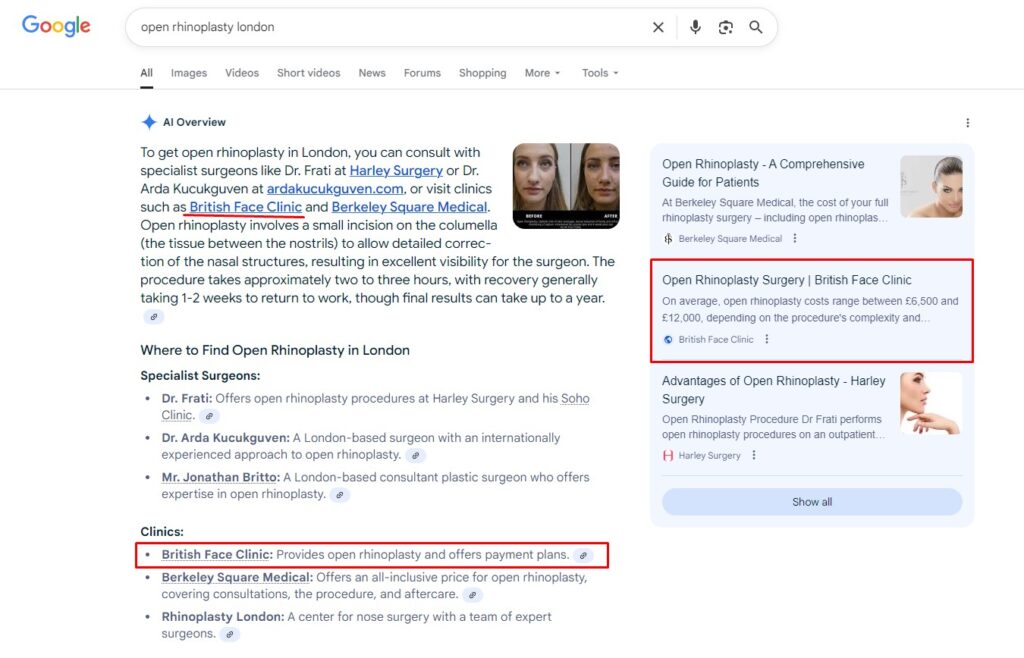 Results SEO Performance AI Keyword Ranking Result Open Rhinoplasty London for British Face Clinic by OMD