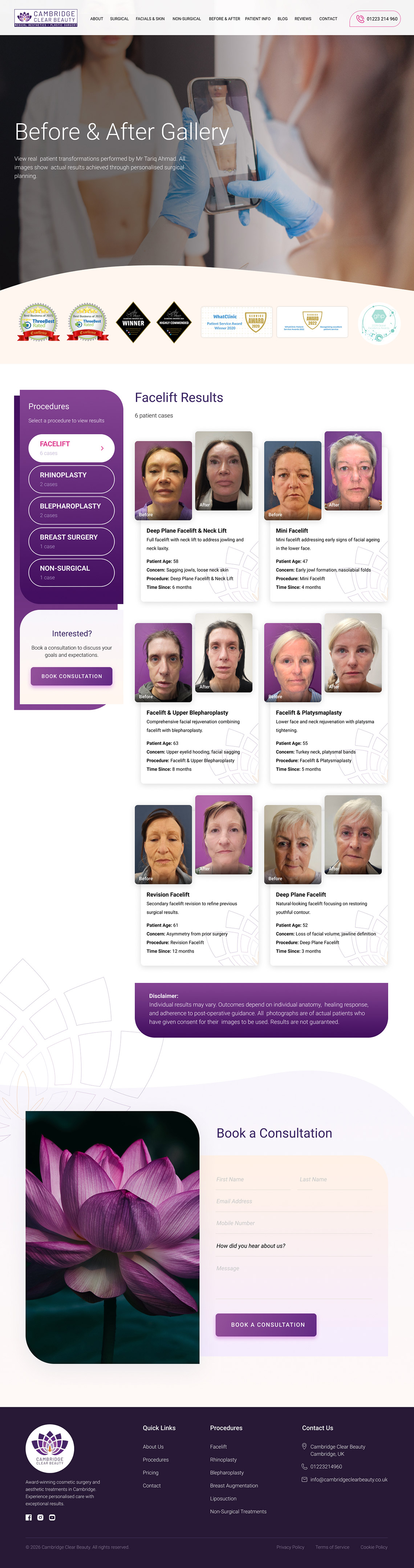 Before & After For Cambridge Clear Beauty By OMD