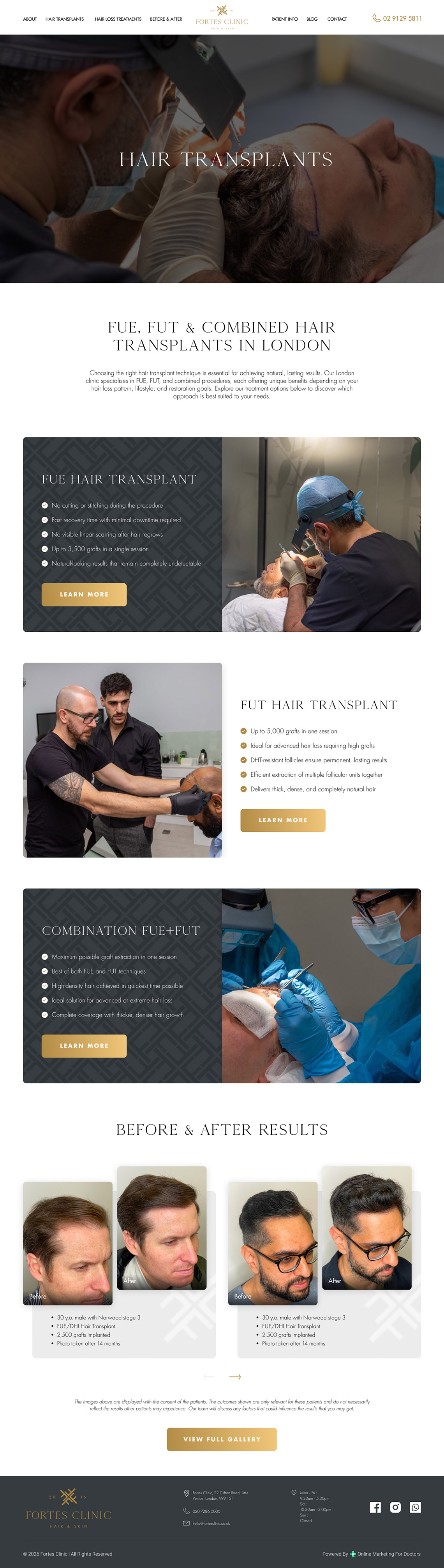 Hair Transplants For Fortes Clinic by OMD