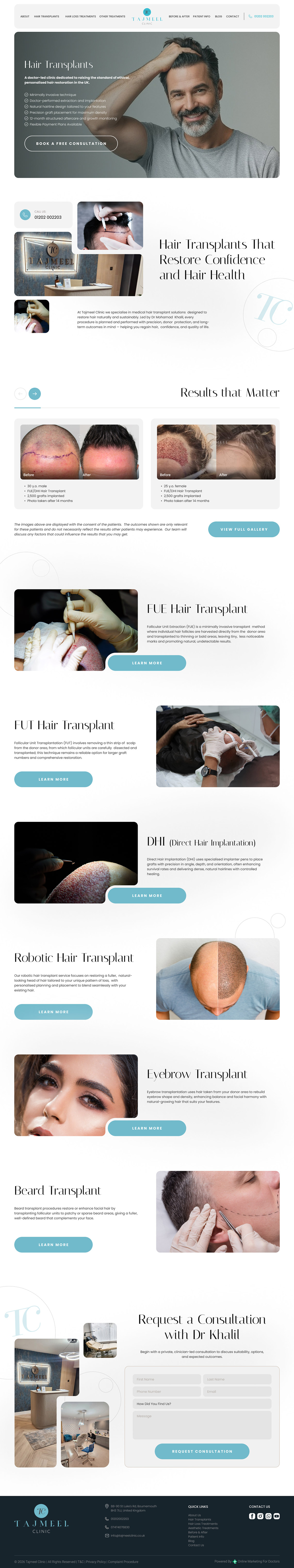 Hair Transplants for Tajmeel by OMD
